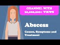 Abscess - Causes, Symptoms and Treatment