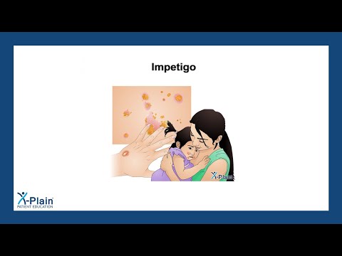 Impetigo