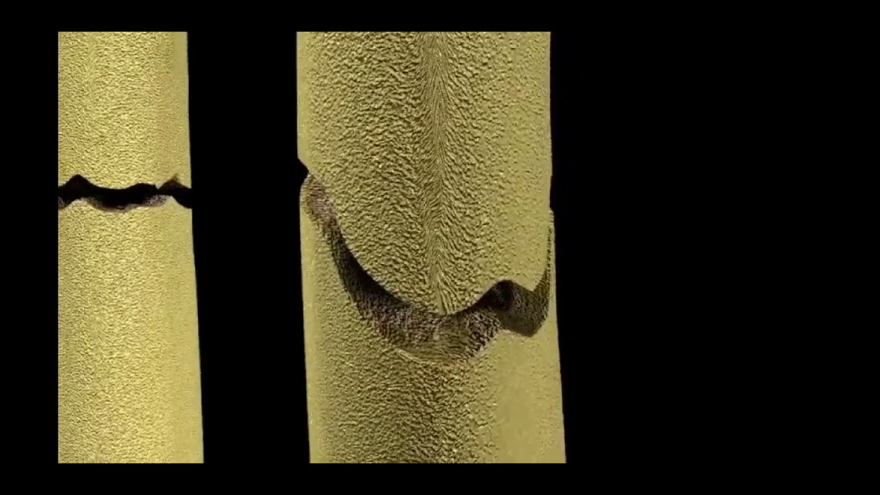 Fracture types labelled 3D Model
