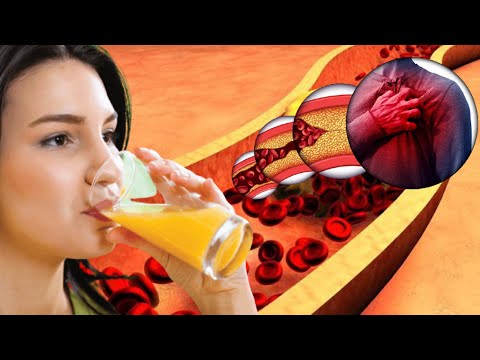 1 GLASS OF THIS JUICE IN THE MORNING REVERSE CLOGGED ARTERIES & LOWER HIGH BLOOD PRESSURE
