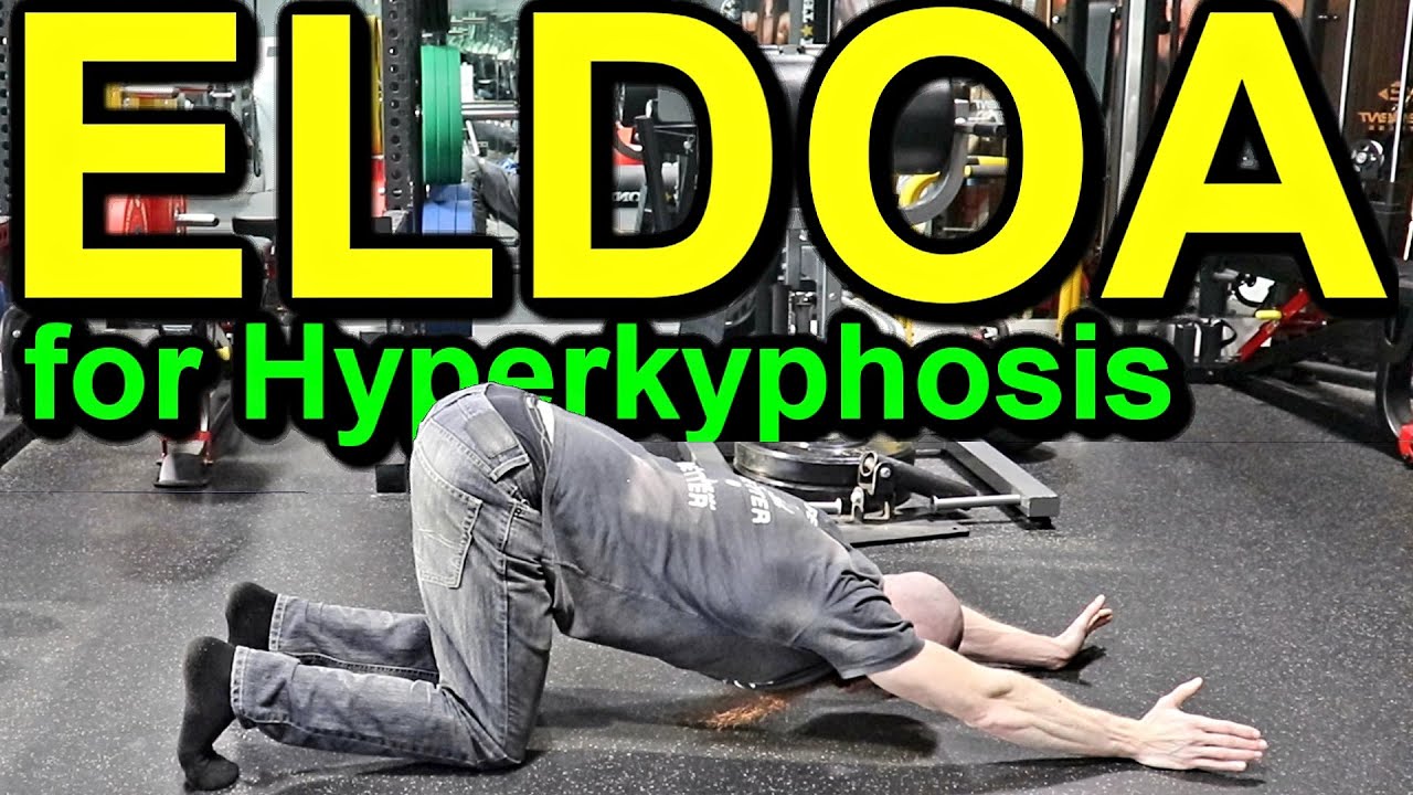 HOW TO CORRECT THORACIC HYPERKYPHOSIS: Top 5 ELDOA