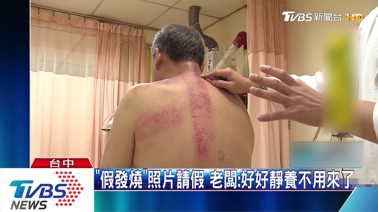 「假發燒」照片請假 老闆:好好靜養不用來了