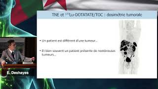 AICONM24 - Approche Dosimétrique dans la RIV des TNE (E DESHAYES)