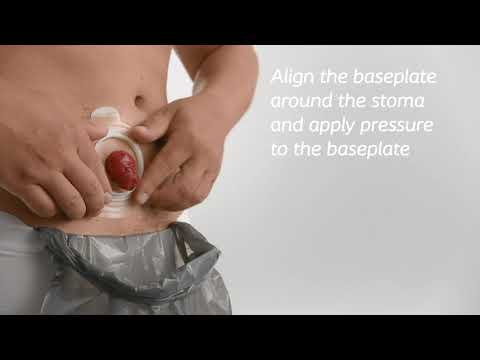 How to use SenSura Mio Click coupling - Open bag