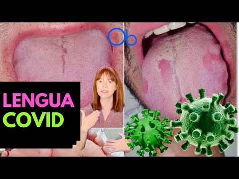 LENGUA COVID 👅 🦠