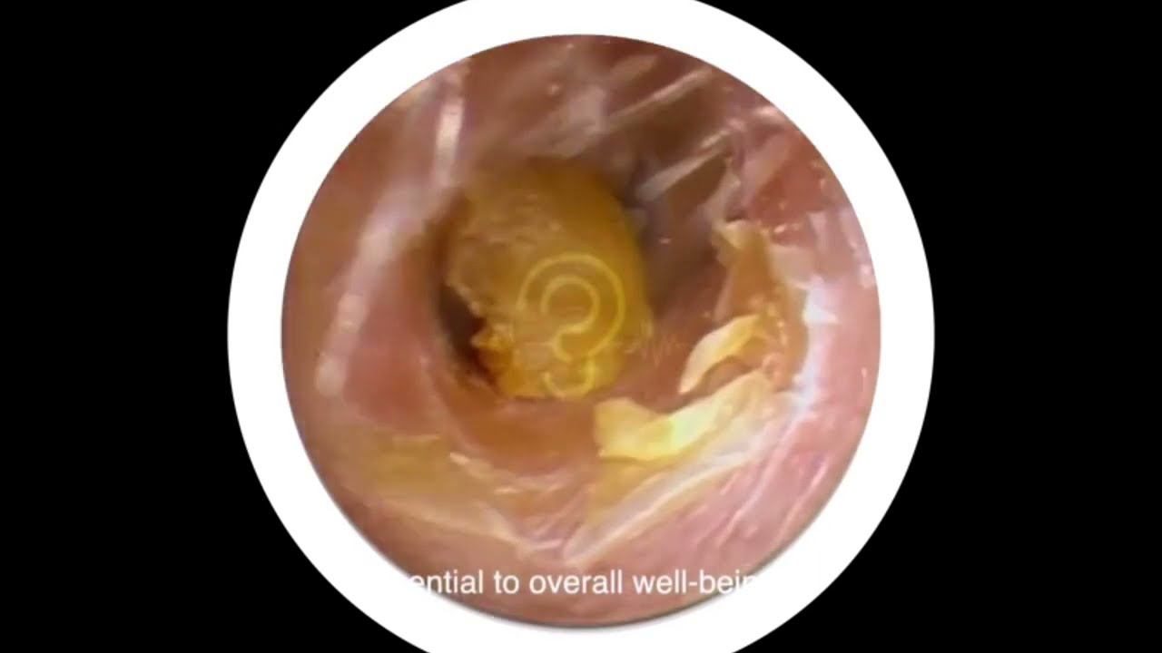 掏耳朵合集，好几种，你喜欢那种耳朵？ #耳朵清洁 #采耳 #强迫症治愈系 快手