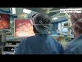 Ruptured Ectopic Pregnancy