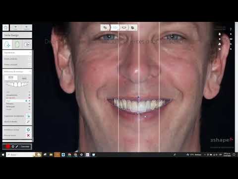 Transform Your Smile: Advanced Smile Makeover Technology at Dentica!