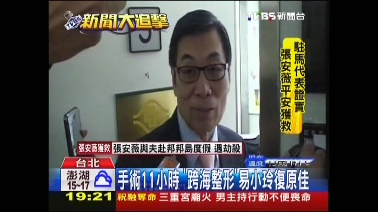 手術11小時 「跨海整形」易小玲復原佳