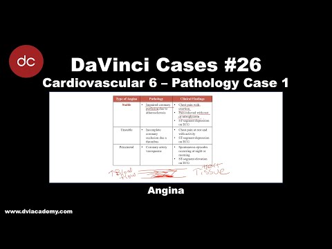 A Case of Angina [#DaVinciCases Cardiovascular 6 - Pathology Case 1]