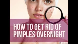 HOW TO GET RID OF PIMPLES OVERNIGHT