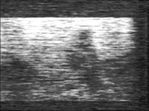 DXTV Kenya Ch E2 20th August 2012.