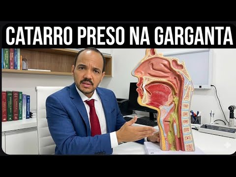 CATARRO PRESO NA GARGANTA: Como eliminar secreção entre o nariz e garganta com pigarro e tosse