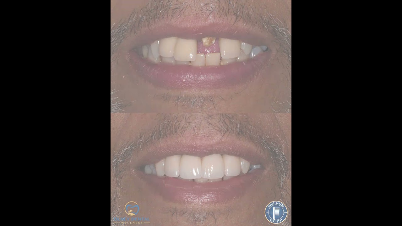 Smile Gallery Video 3