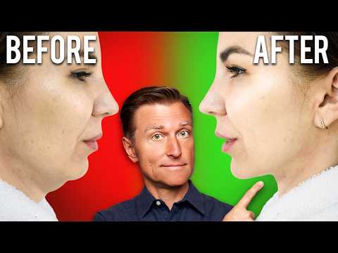 Fastest Way to Rid Your DOUBLE CHIN (Turkey Neck)