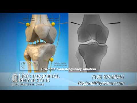 Radiofrequency Ablation for Arthritis Knee Pain