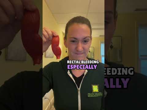 Tearing your anal canal can be super painful! #analfissures #fissuretreatment