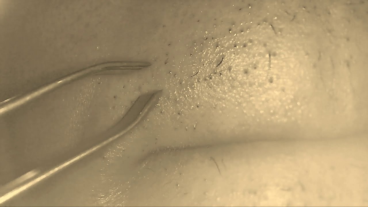 Fully pull out hair Pull out hair smoothly