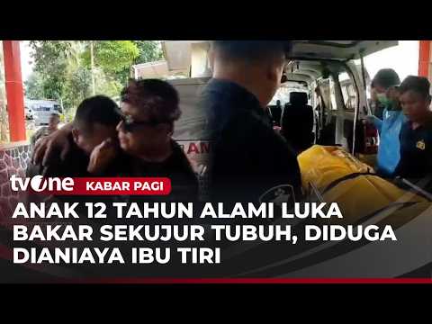 Dianiaya Ibu Tiri, Anak di Sukabumi Meninggal Dunia Akibat Luka Bakar | Kabar Pagi