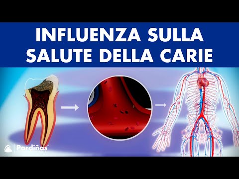 Trattamento Bubnovsky di spalla Toraciche ginnastica trattamento osteocondrosi
