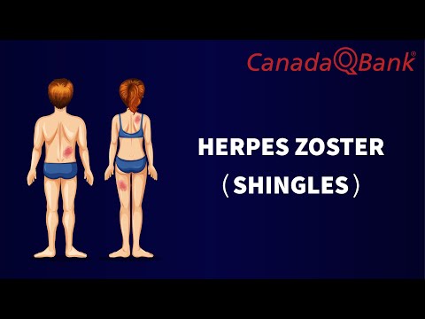 Herpes Zoster (Shingles): Causes, Symptoms & Treatment | Varicella-Zoster Virus Reactivation