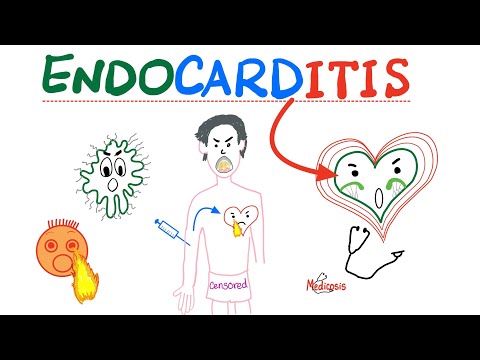 Infective Endocarditis - Fever & New Murmur - Modified Duke’s Criteria - Cardiology Playlist