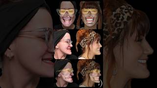 Your Full Mouth Implant Smile Is Only As Good As The Plan! #AllOn4 #AllOn6