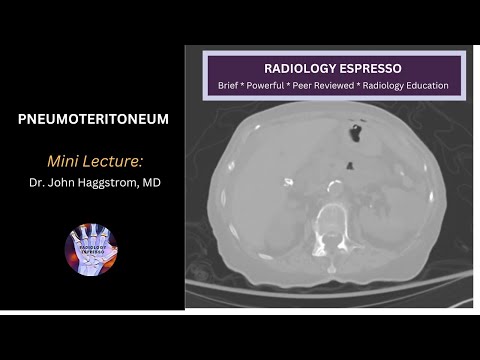 PNEUMOPERITONEUM: Mini Lecture, Dr. John Haggstrom, MD