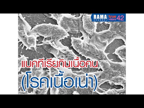 จากสิ่งที่อาจจะมีความอ่อนแอ Pyelonephritis และความแข็งแรง