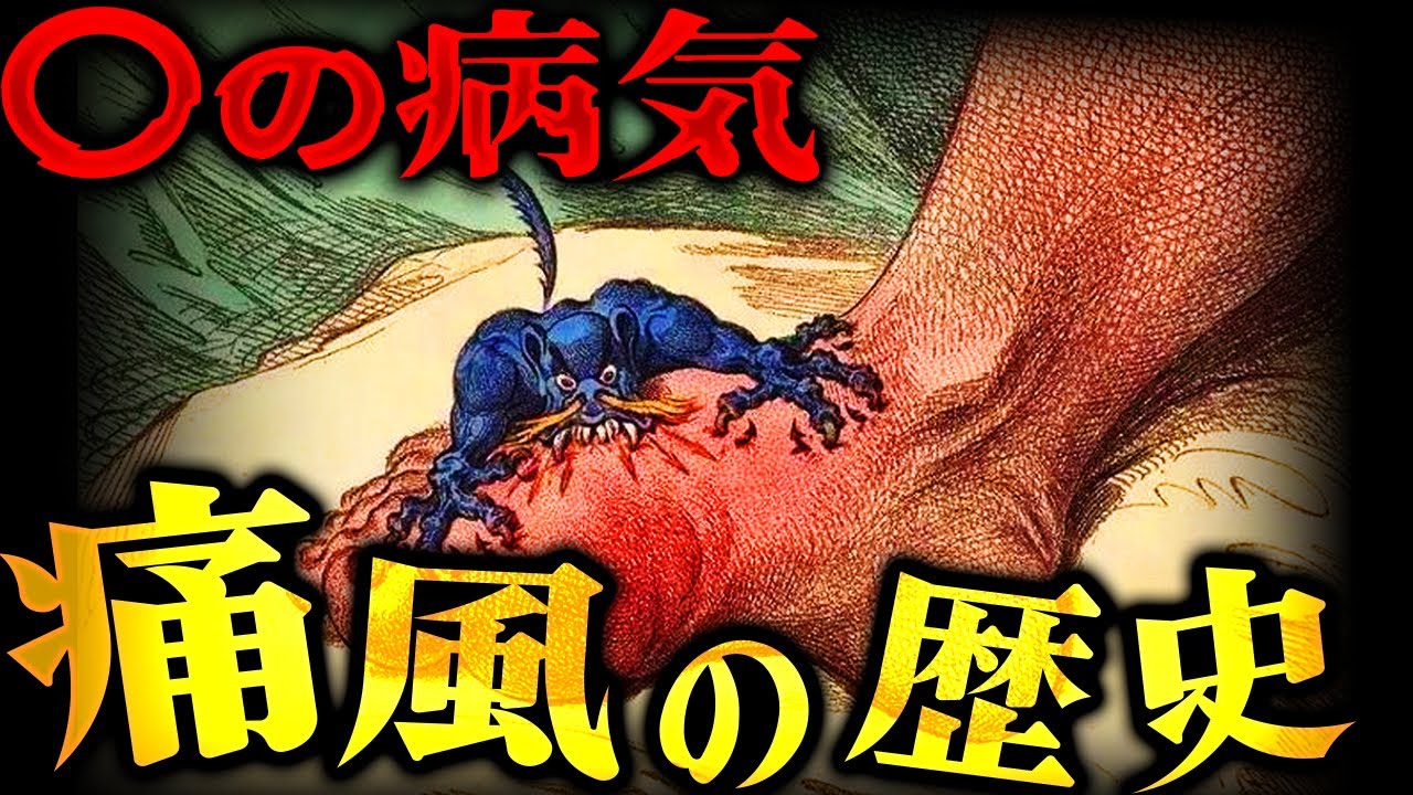 誰も知らない痛風の驚くべき歴史とその治し方…。