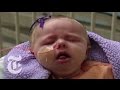 Vaccines: An Unhealthy Skepticism | MEASLES Virus.