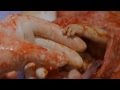 Эмбрион жмёт руку врачу - никогда такого не видел! 