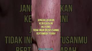 Download lagu TIPS TO PREVENT BREAKDOWN ON YOUR FACE FROM GETTING WORSE mp3