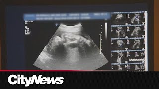 Researchers discover test to identify preterm birth risk