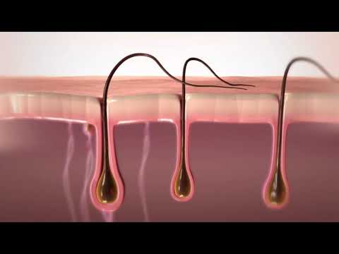 Belle Bella IPL Hair Removal Video