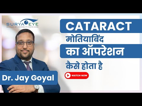 Cataract Surgery Explained: Quick, Painless & Advanced Procedure by Dr. Jay Goyal