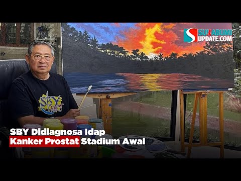 SBY Didiagnosa Idap Kanker Prostat Stadium Awal