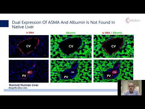 Clinical Development of Medicinal Signaling Cells (HepaStem®) for Liver Regenerative Therapy