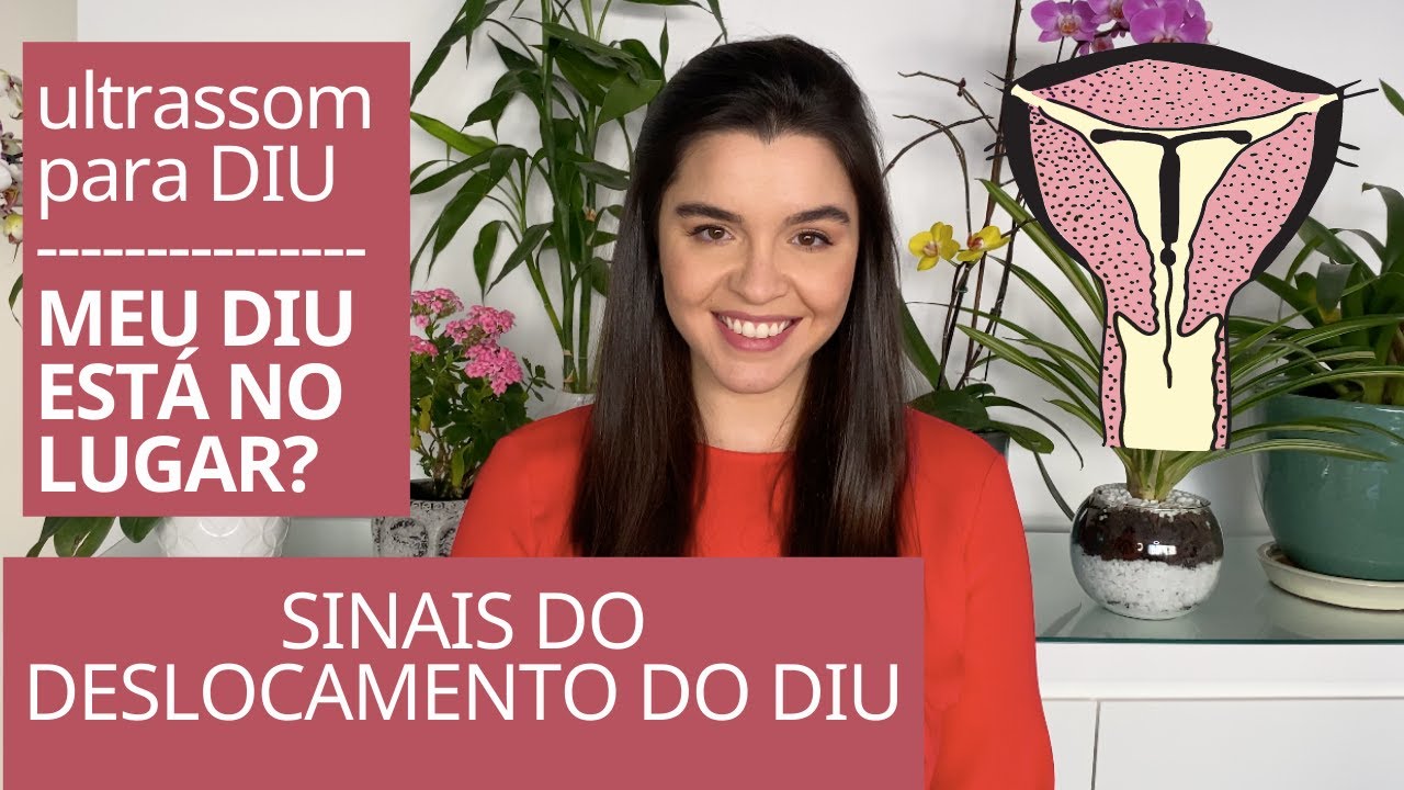 Watch Now Como eu sei se meu DIU está no lugar Deslocamento do DIU, precisa de ultrassom Meu DIU está baixo Como eu sei se meu DIU está no lugar Deslocamento do DIU, precisa de ultrassom Meu DIU está baixo