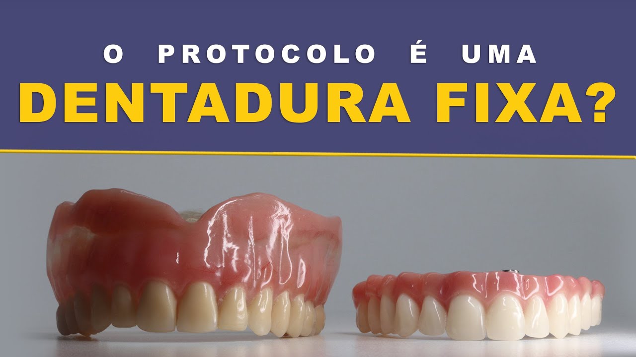 DENTADURA FIXA É PROTOCOLO?