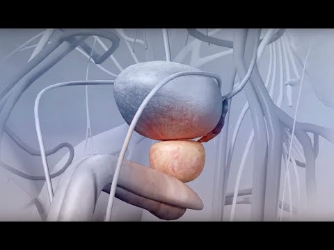 Moxifloxacin prostatitis dosage