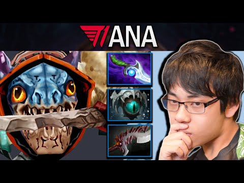 Slark Dota 2 Gameplay T1.Ana with 22 Kills and Skadi