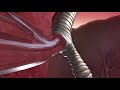 The Mechanics of an Asthma Attack. An Animated Insight