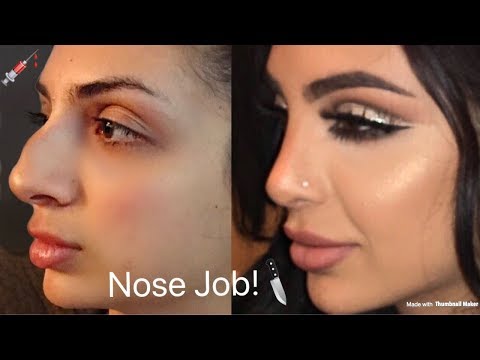 Watch lagu Images Videos Celebrity With Bump On Nose, Watch Images Celebrity With Bump On Nose free Watch Images, Watch Images Celebrity With Bump On Nose