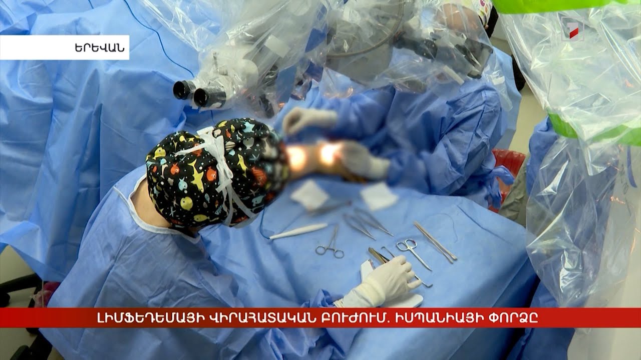 Լիմֆեդեմայի վիրահատական բուժում. իսպանացի բժիշկների փորձը