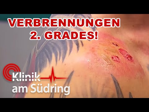 Geheimnis in der Notaufnahme: Mysteriöse Verbrennung 2. Grades! | Klinik am Südring | SAT.1
