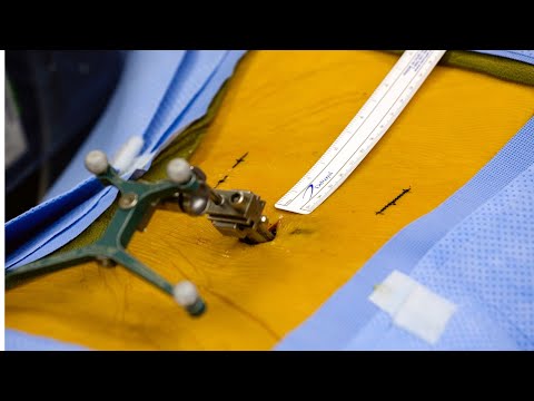 Patient Testimonials | Dr. Ajay Kothari - Spine Surgeon | Shivaji Nagar, Pune