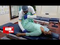 Gas Acidity Chiropractic Treatment Www Drrajneeshkant Com