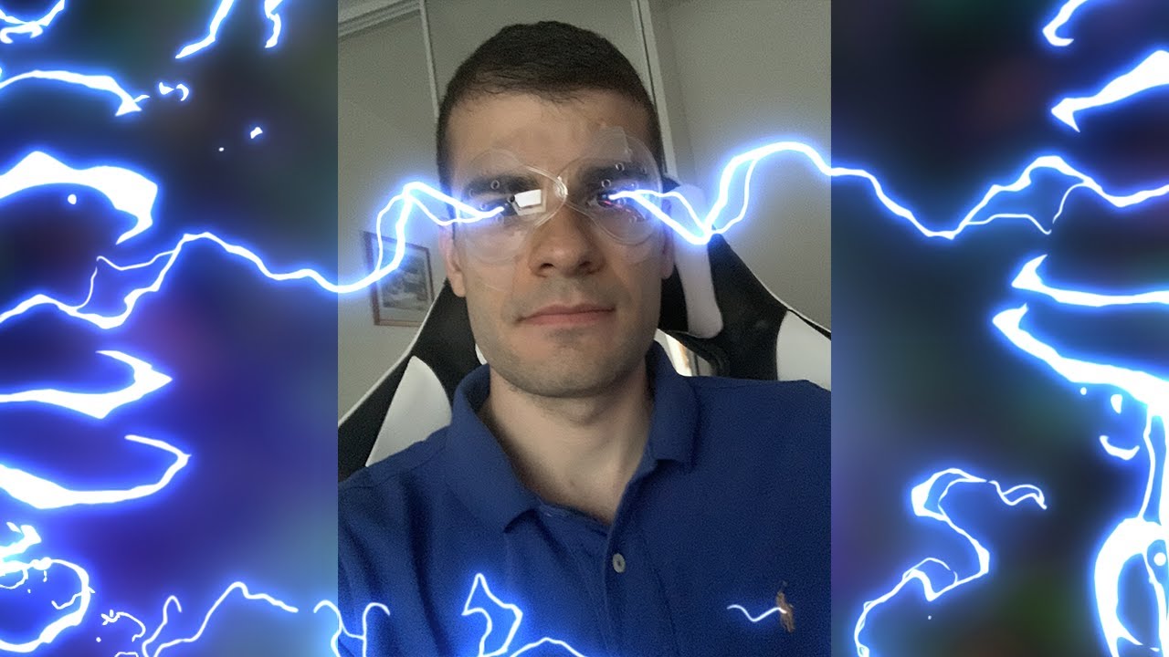 Watch video Opération des yeux LASIK - 1 semaine après Opération des yeux LASIK - 1 semaine après