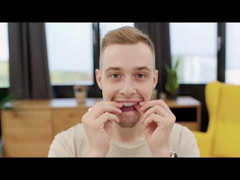 DR SMILE Aligner: Jakub investiert in die Zukunft – mit seinem neuem Lächeln!